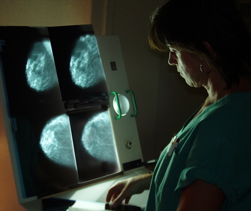 Mamografia
